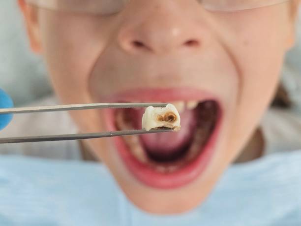 Best Urgent Tooth Repair  in Newark, OH