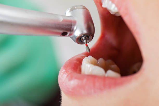 Best Cracked Tooth Emergency Dentist  in Newark, OH